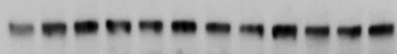 FBXO11 Antibody NB100-59826