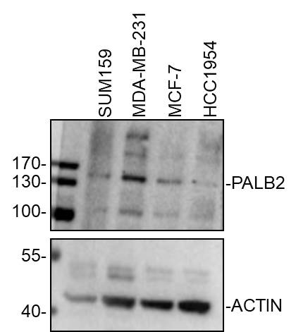 PALB2 Antibody - BSA Free NB100-60439