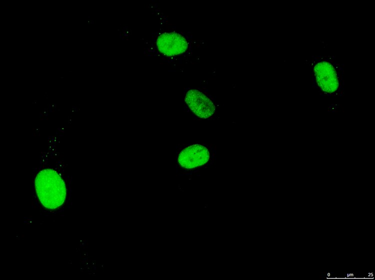 RECQ1 Antibody - BSA Free NB100-619