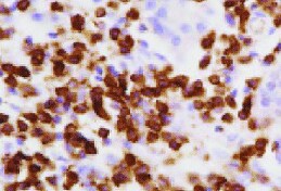 CD8 Antibody (12.C7) - BSA Free NB100-64021