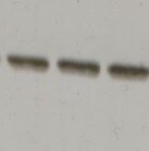 Complement C8A/B/G Antibody (056B-373) - BSA Free NB100-64340