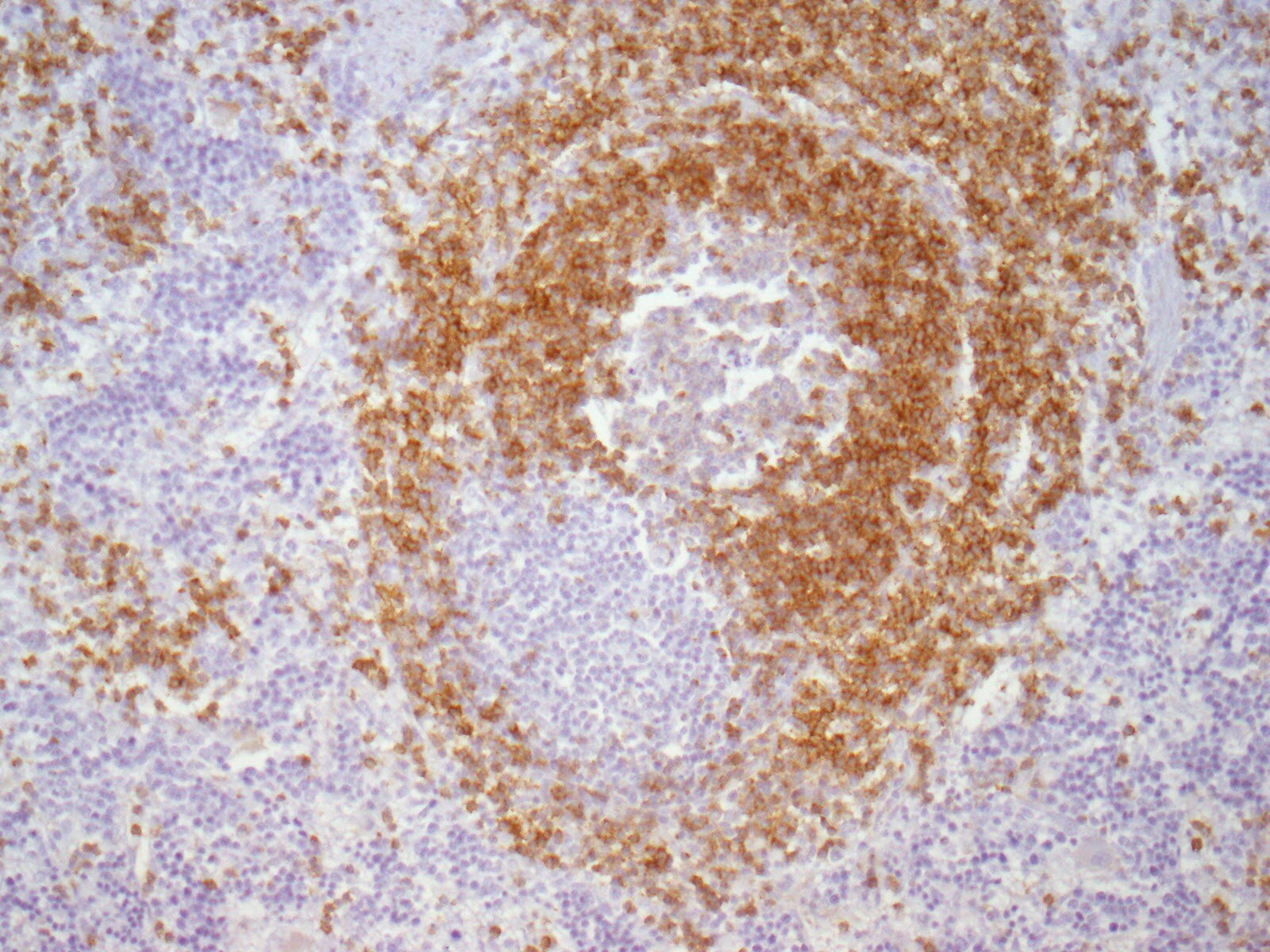CD79A Antibody (HM57) - BSA Free NB100-64347
