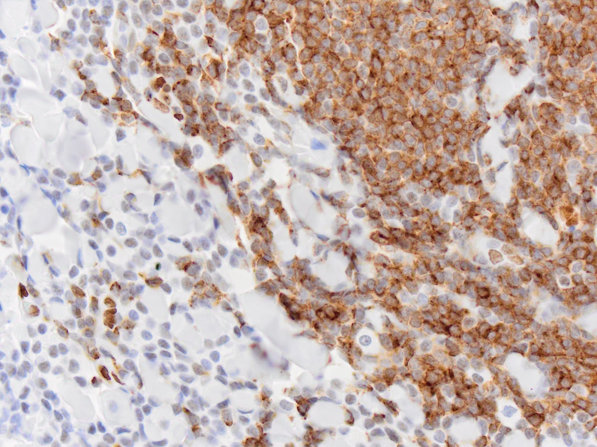 CD79A Antibody (HM57) - BSA Free NB100-64347