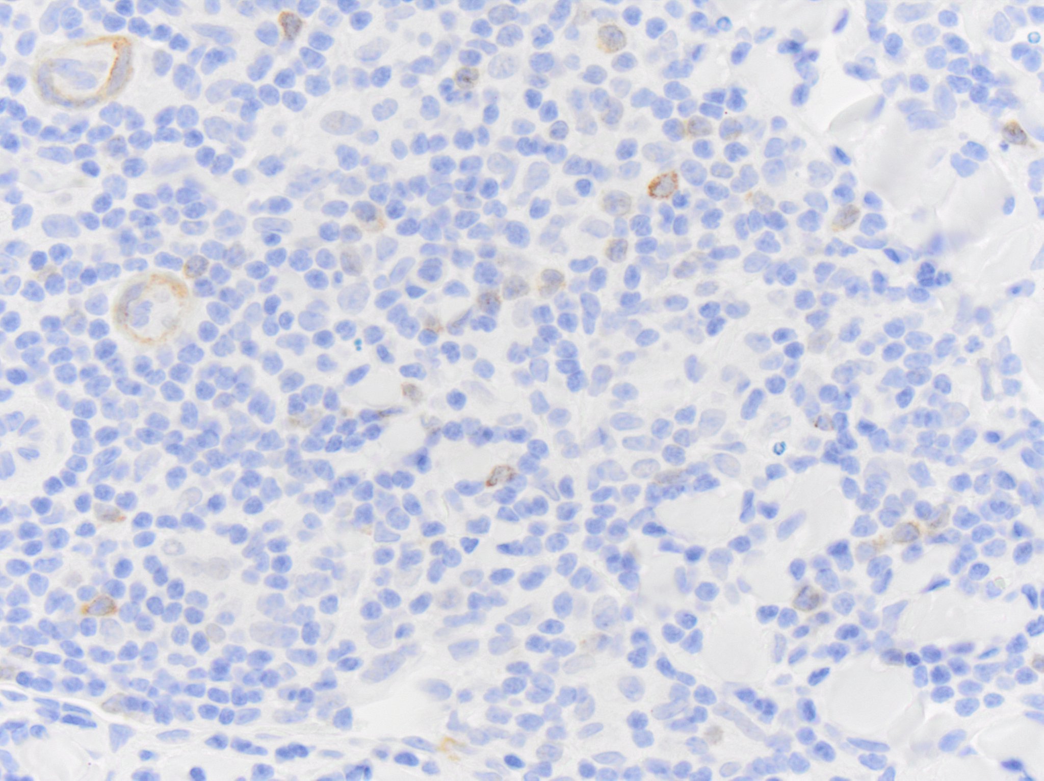 CD79A Antibody (HM57) - BSA Free NB100-64347