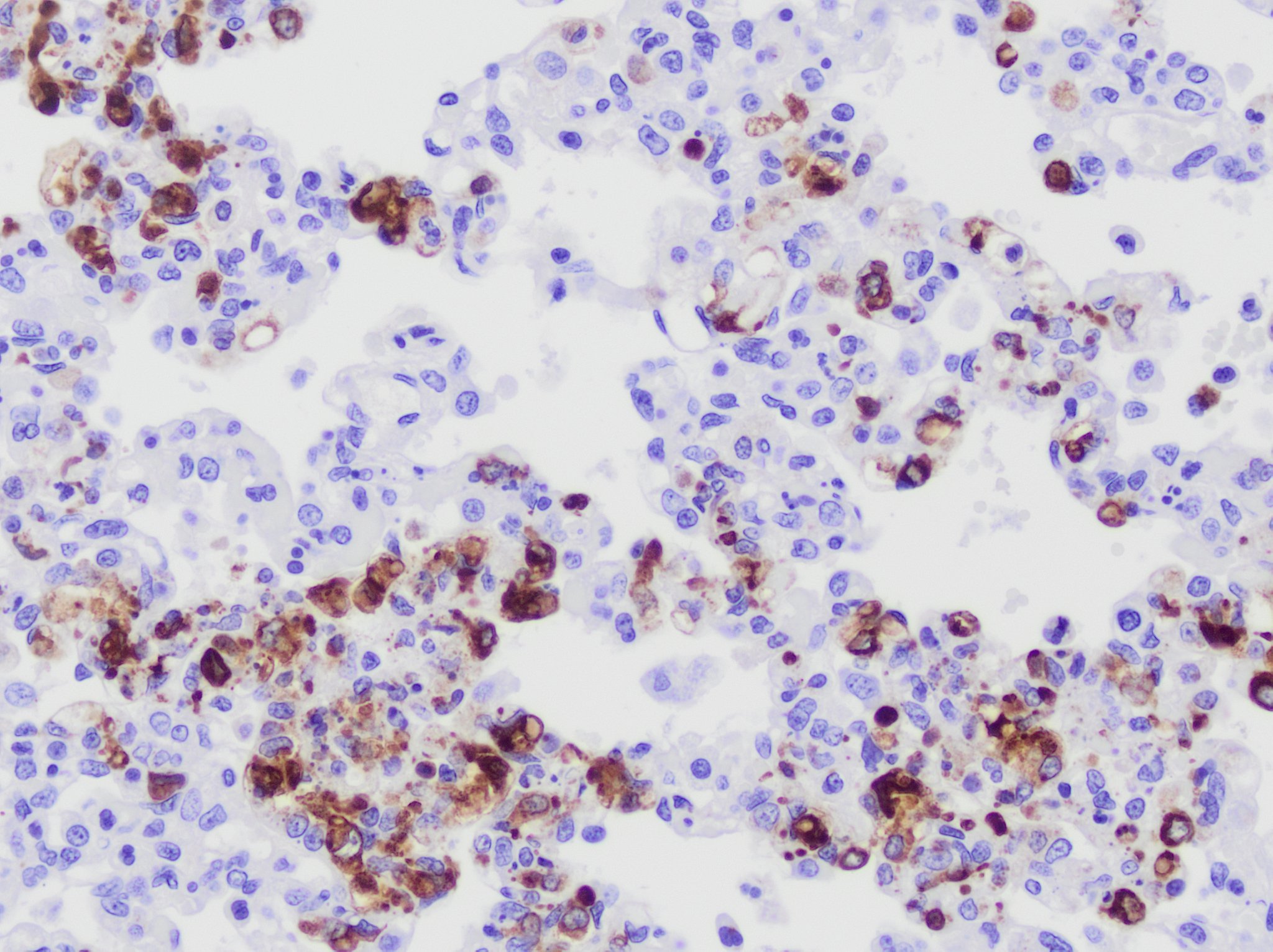 Coronavirus Antibody (FIPV3-70) - BSA Free NB100-64754