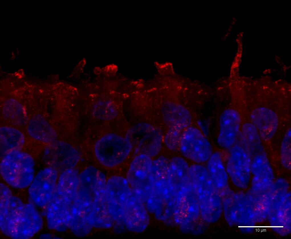 Actin Gamma 1 Antibody (NH3) - BSA Free NB100-64792