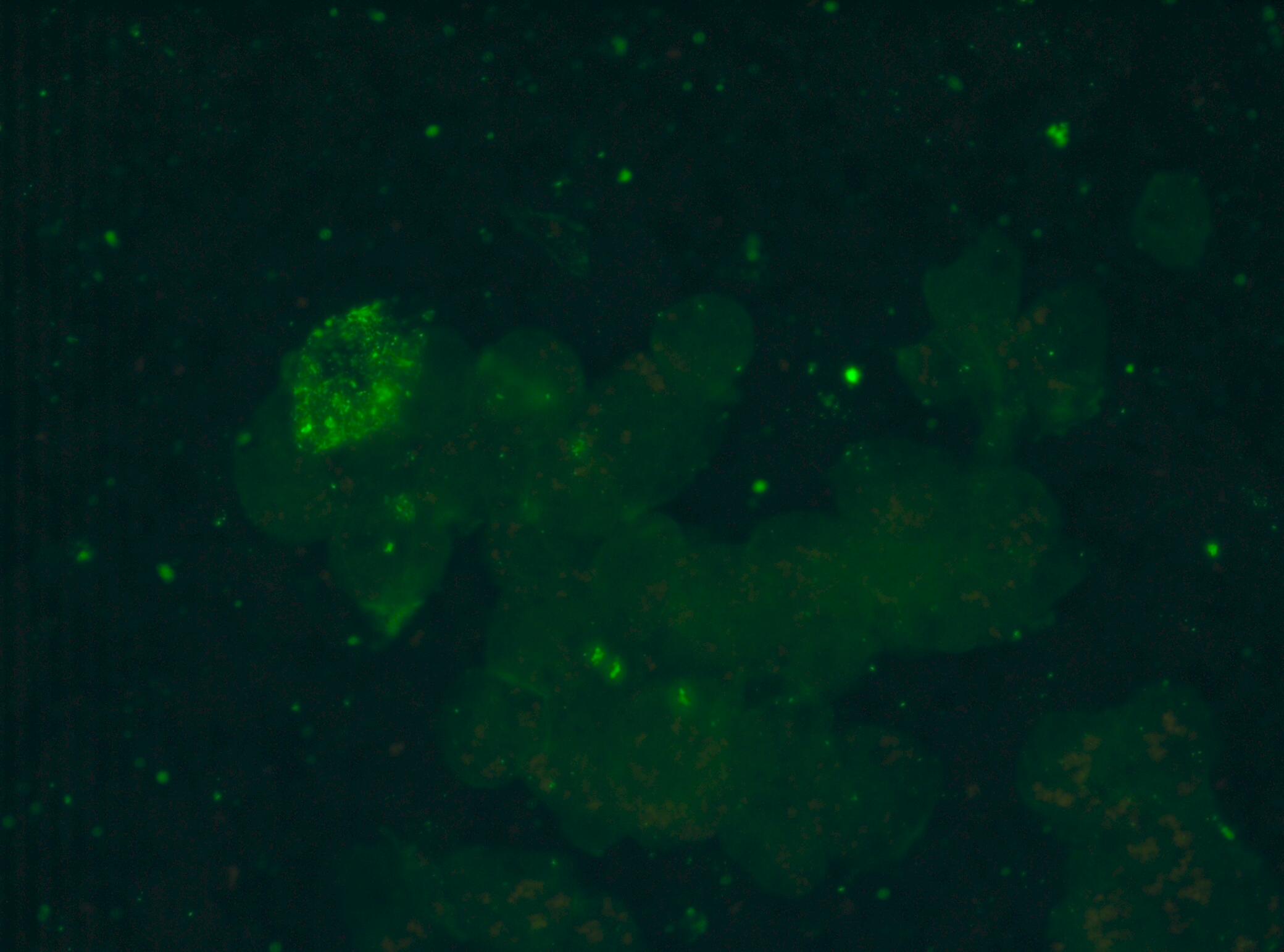 CD1a Antibody (NA1/34-HLK) - BSA Free NB100-64852
