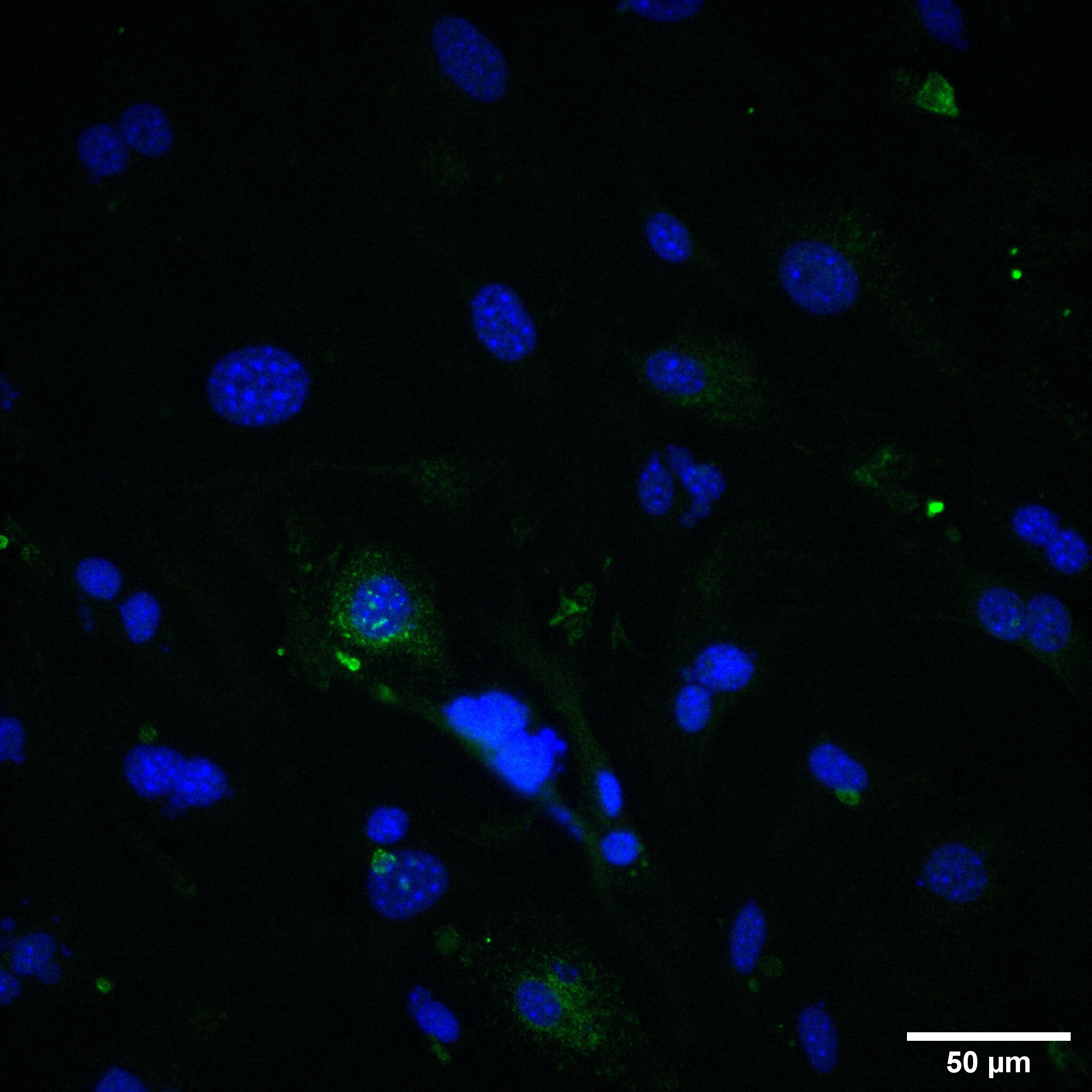 TfR (Transferrin R) Antibody (8D3) - Azide Free NB100-64979
