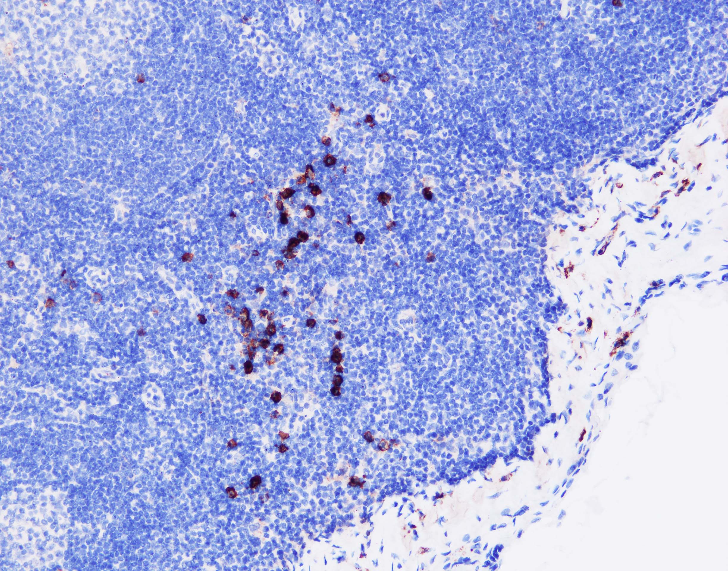 Syndecan-1/CD138 Antibody (B-A38) NB100-64980