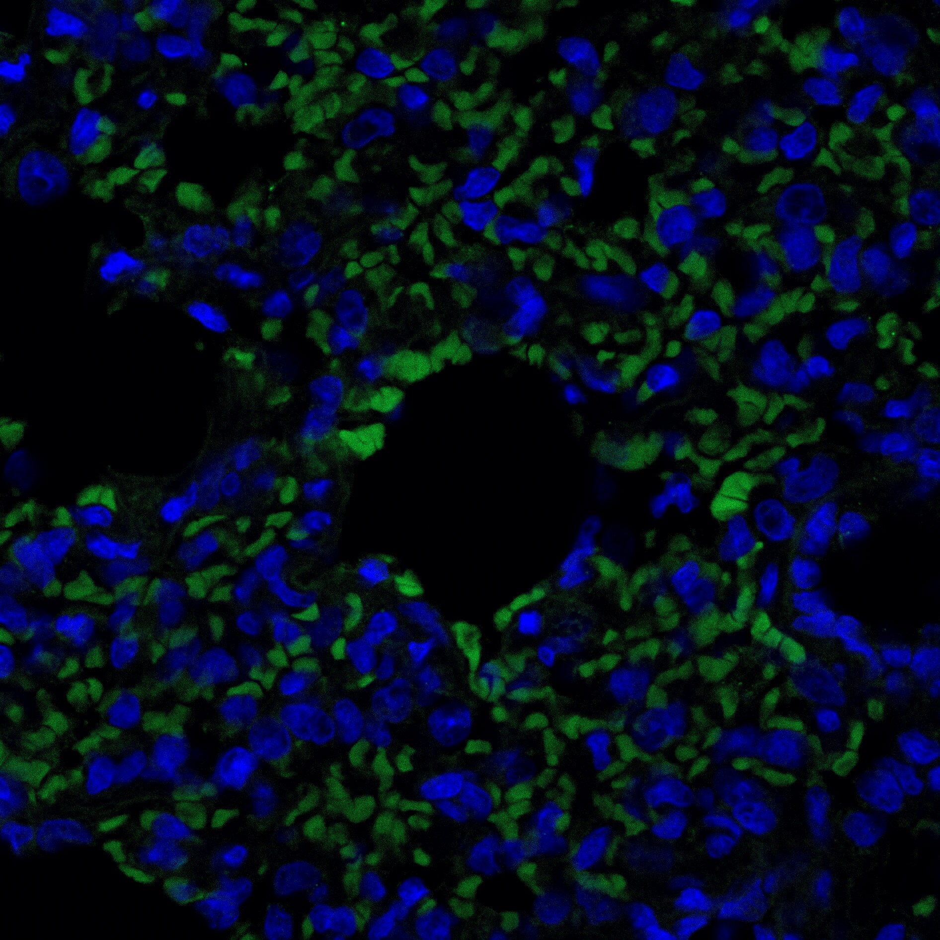 CD161 Antibody (10/78) - BSA Free NB100-65297