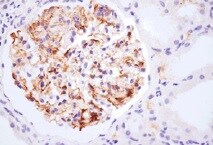 Complement C3d Antibody (053A-1149.3.1.4 (1003)) - BSA Free NB100-65510