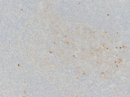 HIV-1 Gag p24 Antibody (28E0) - BSA Free NB100-65515