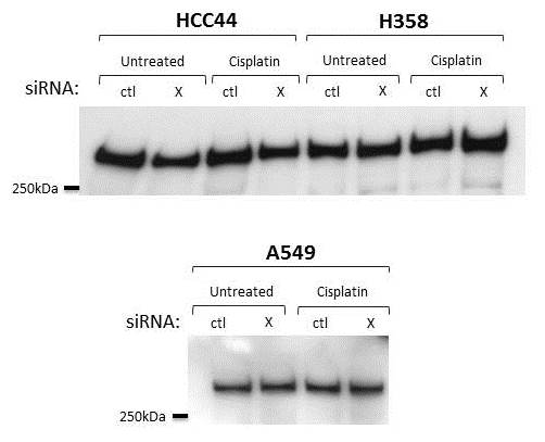 ATM Antibody - BSA Free NB100-678