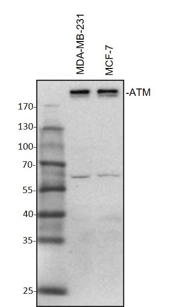 ATM Antibody - BSA Free NB100-678
