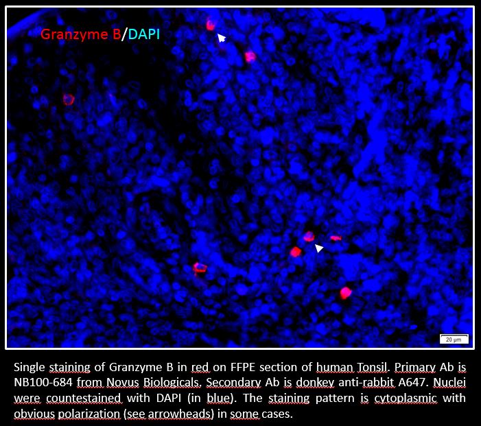 Granzyme B Antibody NB100-684