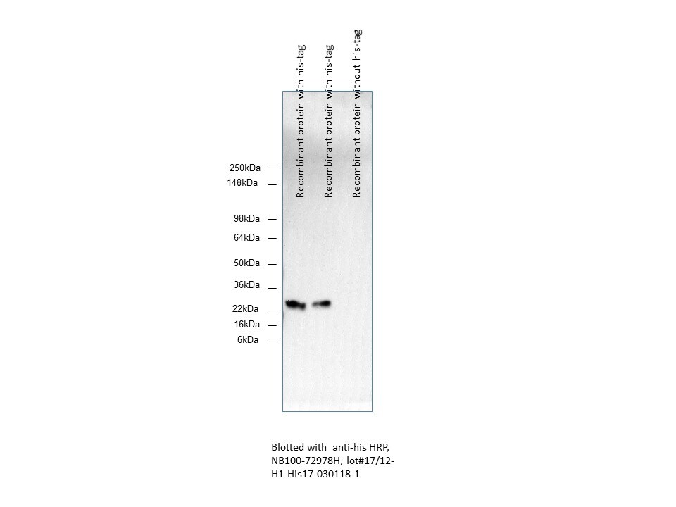 His Tag Antibody (His17) [HRP] NB100-72978H
