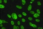 Acetyl-Lysine Antibody (1C6) NB100-74339