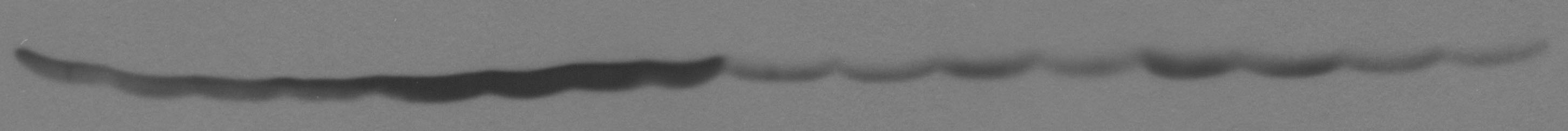 Actin Antibody (mAbGEa) - BSA Free NB100-74340