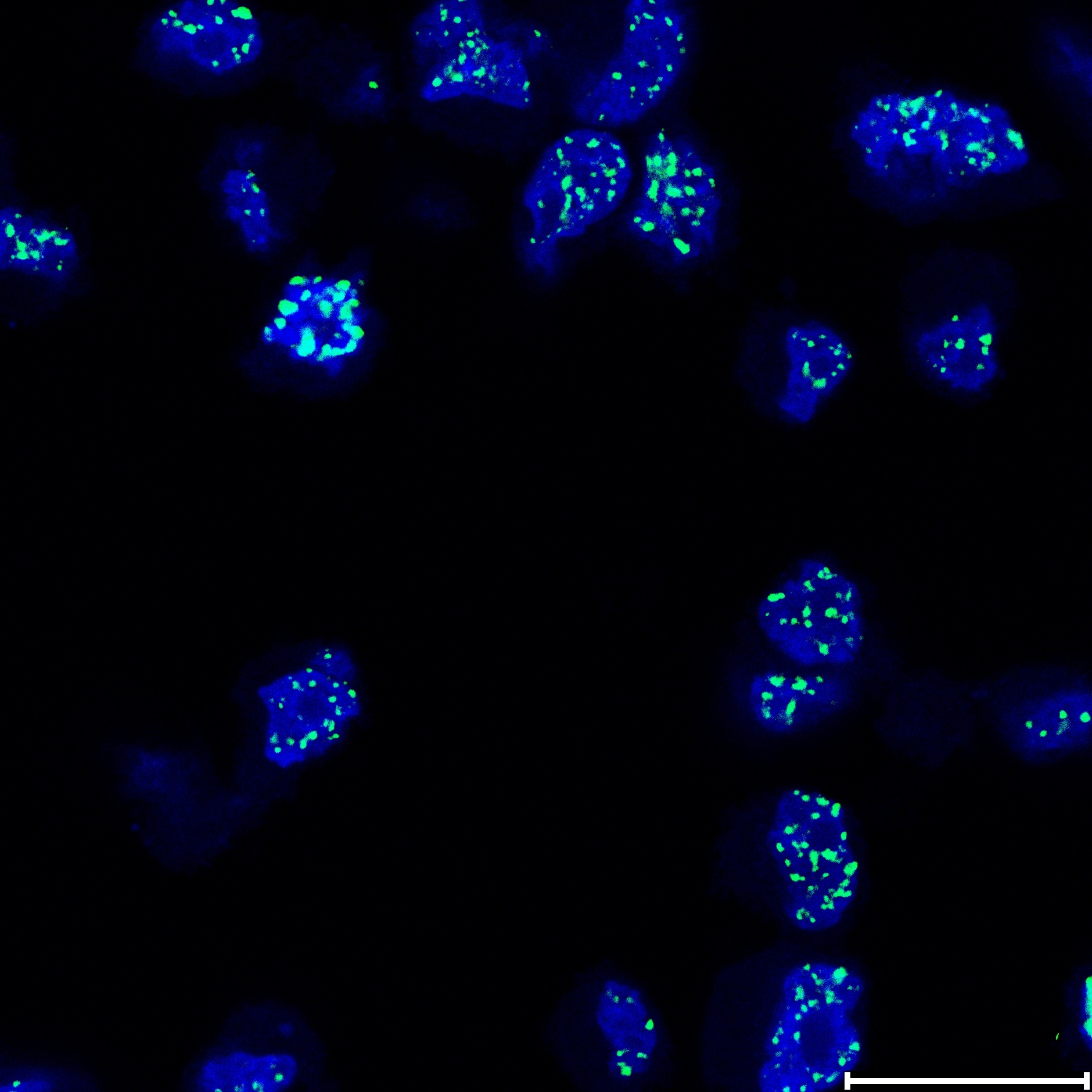Histone H2AX [p Ser139] Antibody (3F2) NB100-74435