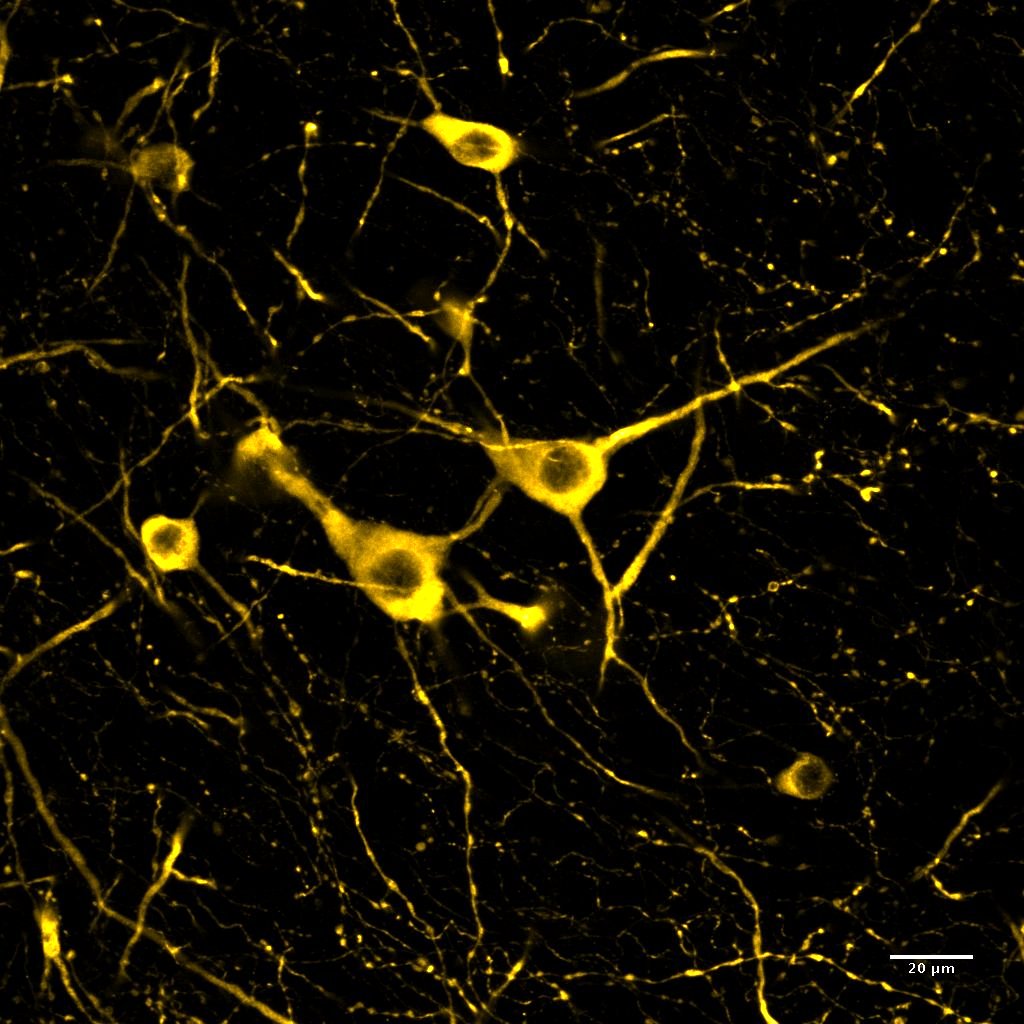 Tryptophan hydroxylase 2 Antibody - BSA Free NB100-74555