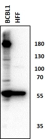 ZNF638 Antibody NB100-77291