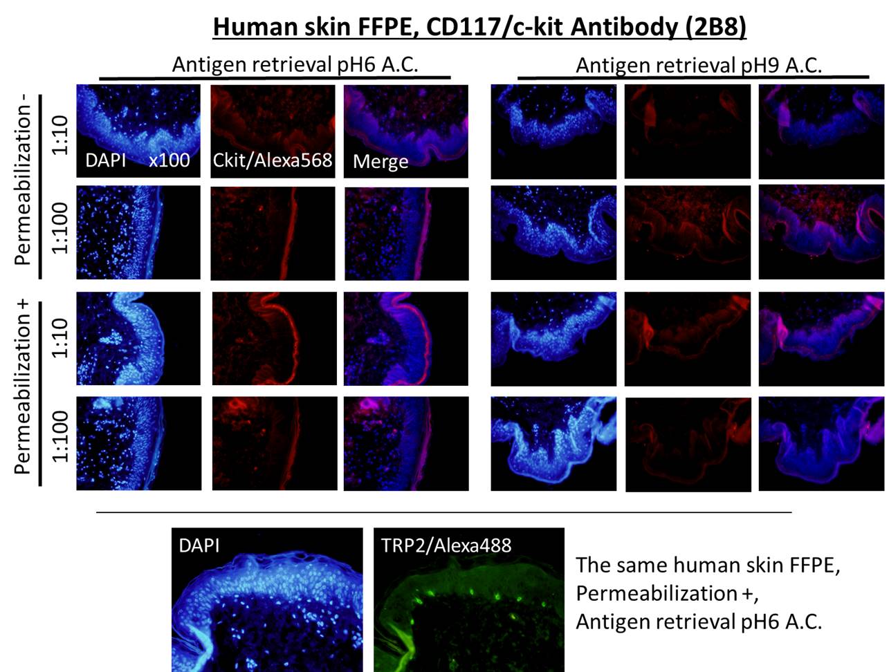 CD117/c-kit Antibody (2B8) - BSA Free NB100-77477