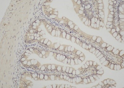 CD14 Antibody (M5E2) - BSA Free NB100-77758