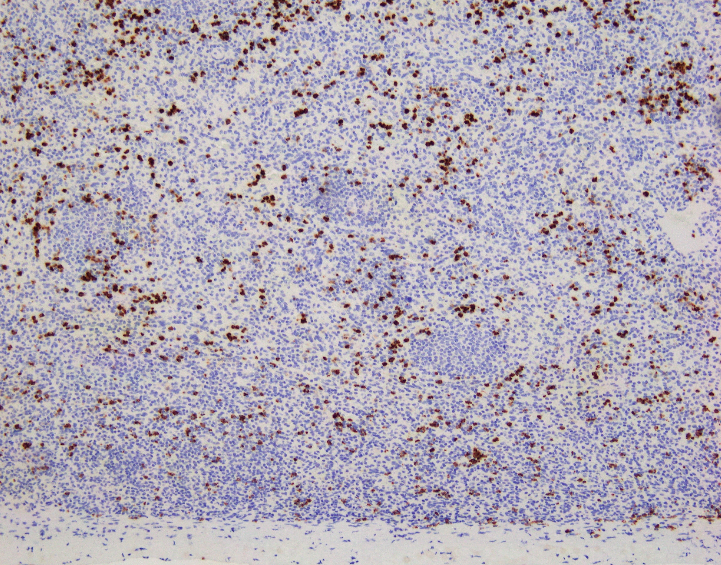 CEACAM8/CD66b Antibody (G10F5) - BSA Free NB100-77808