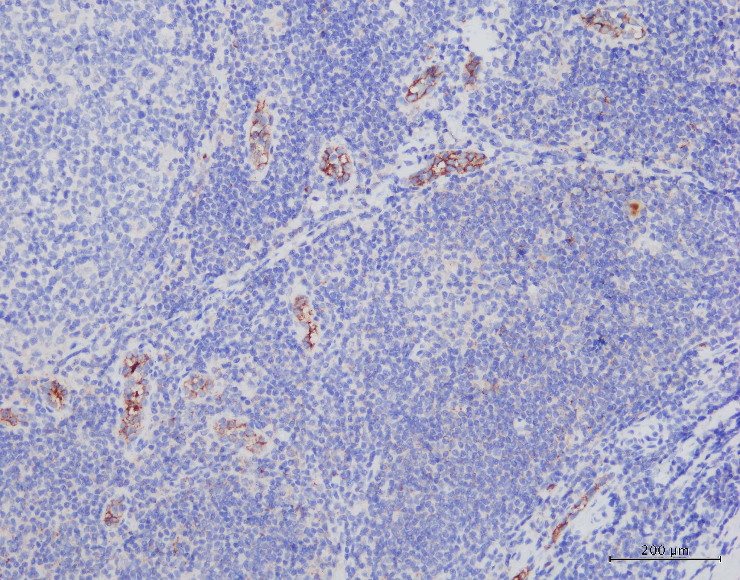 PSGL-1/CD162 Antibody (HECA-452) - BSA Free NB100-78039