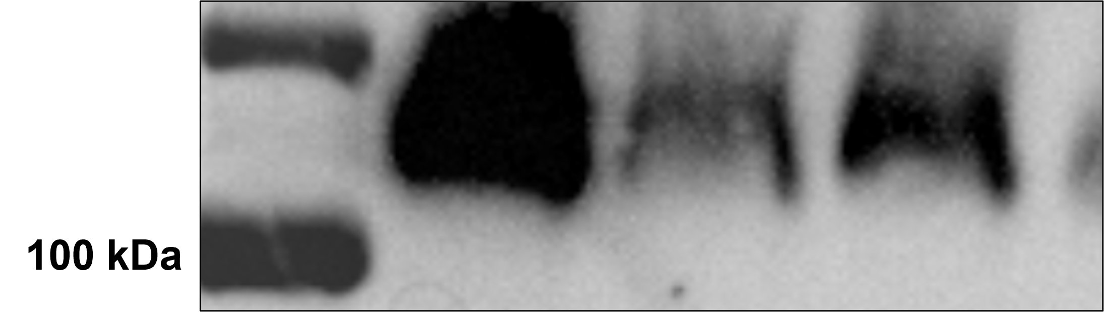 FTSJD2 Antibody - BSA Free NB100-79786