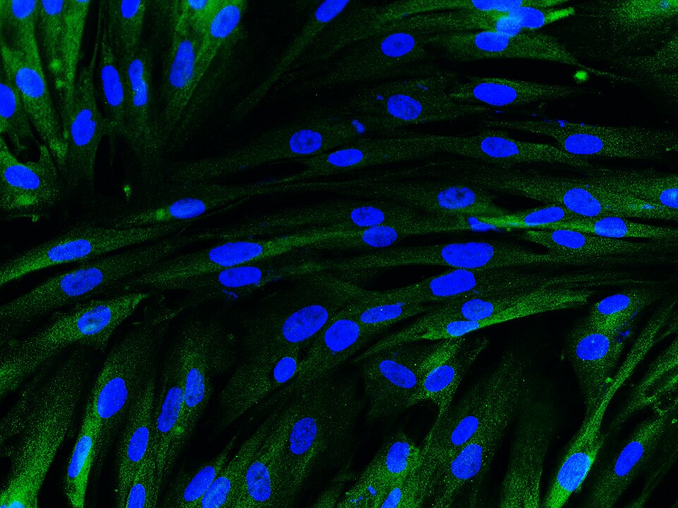 ER alpha/NR3A1 Antibody NB100-81909