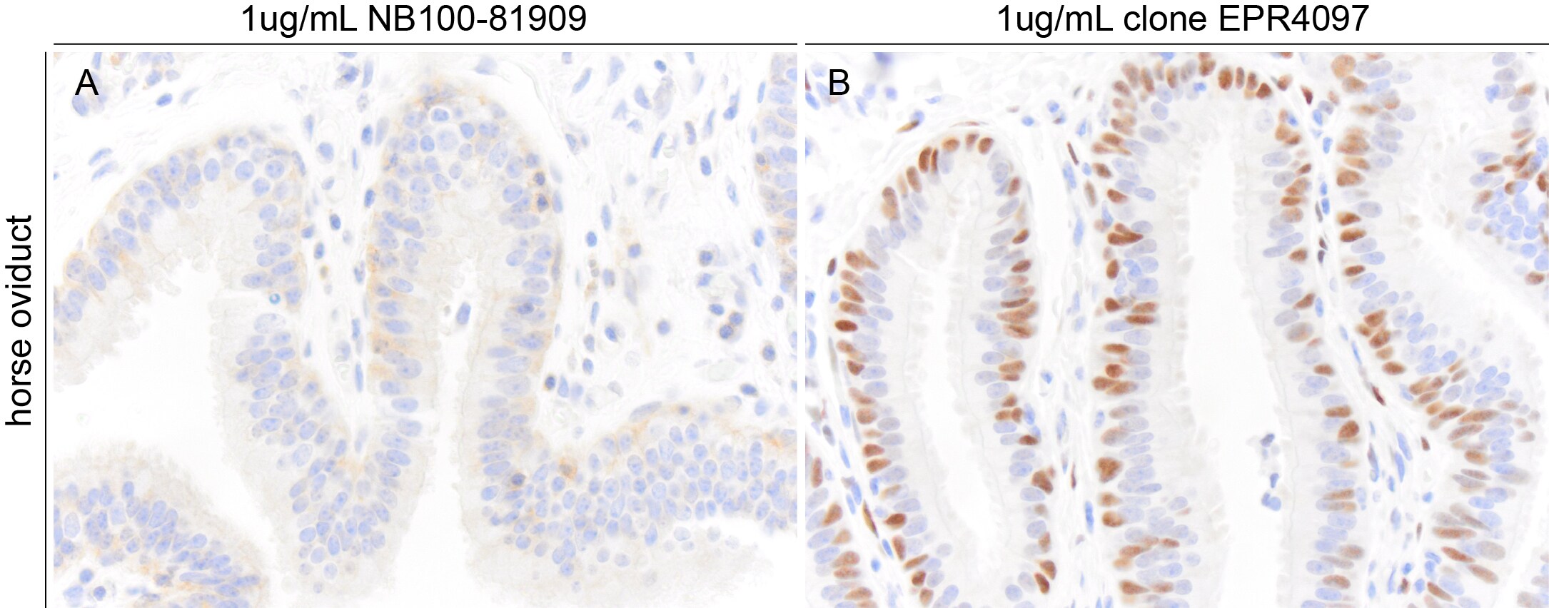 ER alpha/NR3A1 Antibody NB100-81909