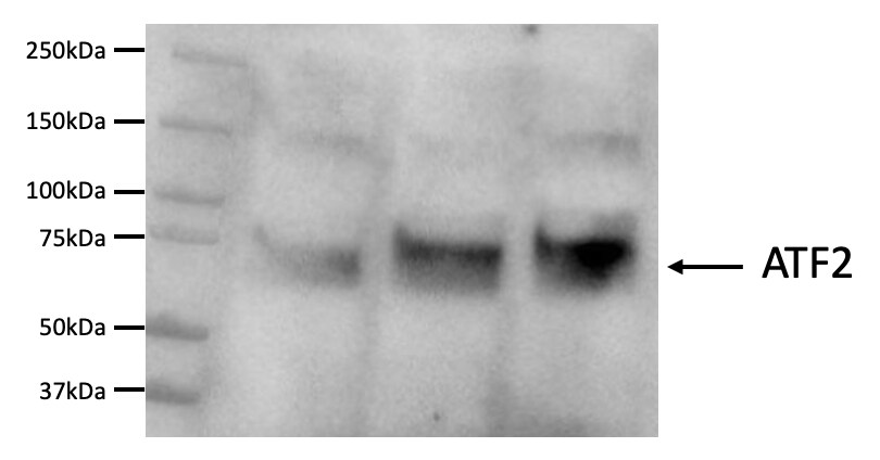 ATF2 Antibody NB100-835