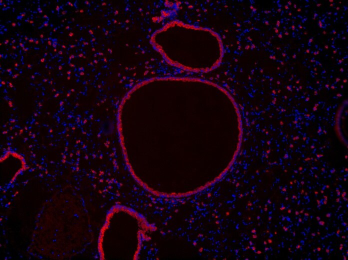 COX-2 Antibody NB100-868