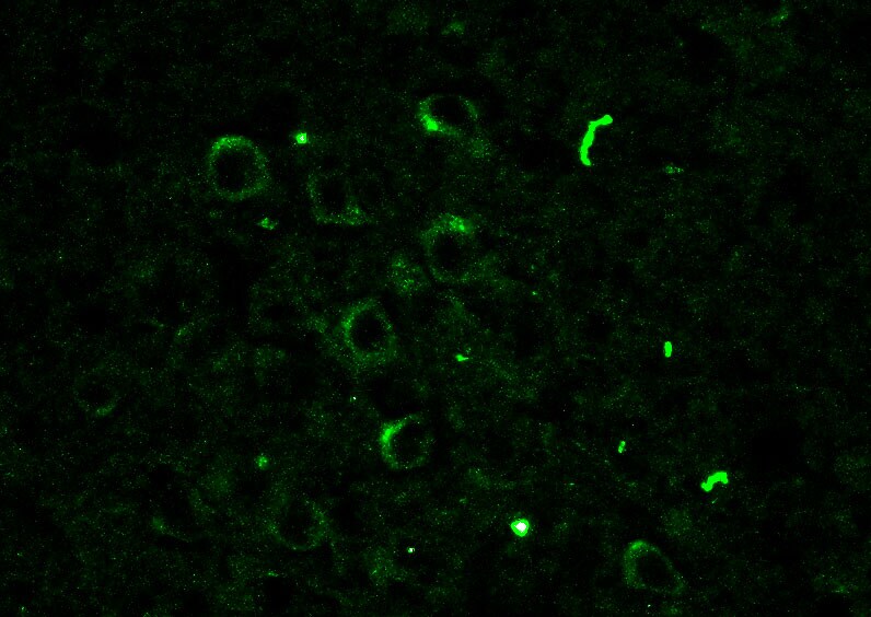 Rac1 Antibody NB100-91266