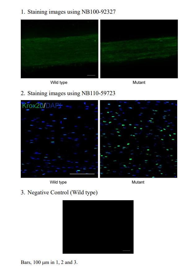 EGR2 Antibody - BSA Free NB100-92327