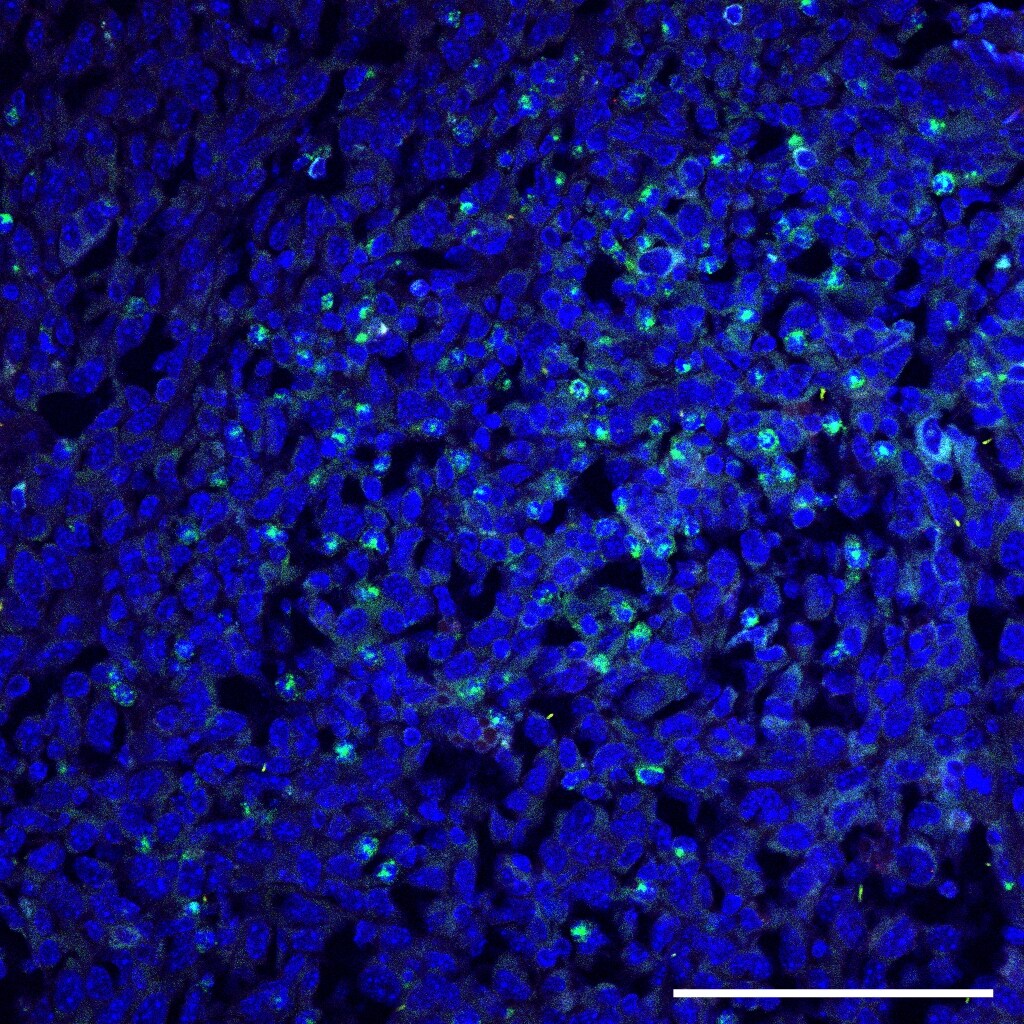 Salmonella typhimurium Antibody (1E6cc) [Alexa Fluor® 488] NB110-16952AF488