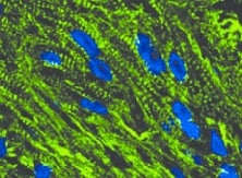 Troponin I Type 3 (cardiac) Antibody (19C7cc) - BSA Free NB110-2546