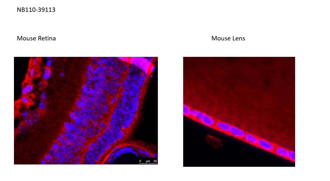 Glut1 Antibody - BSA Free NB110-39113