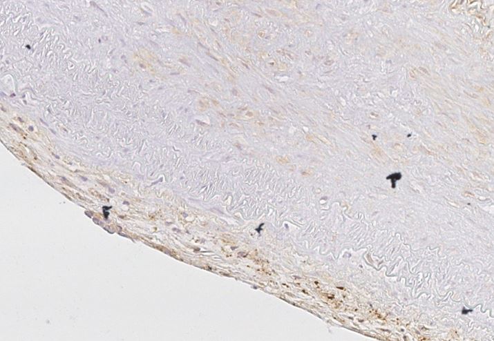 CD163 Antibody (EDHu-1) - BSA Free NB110-40686