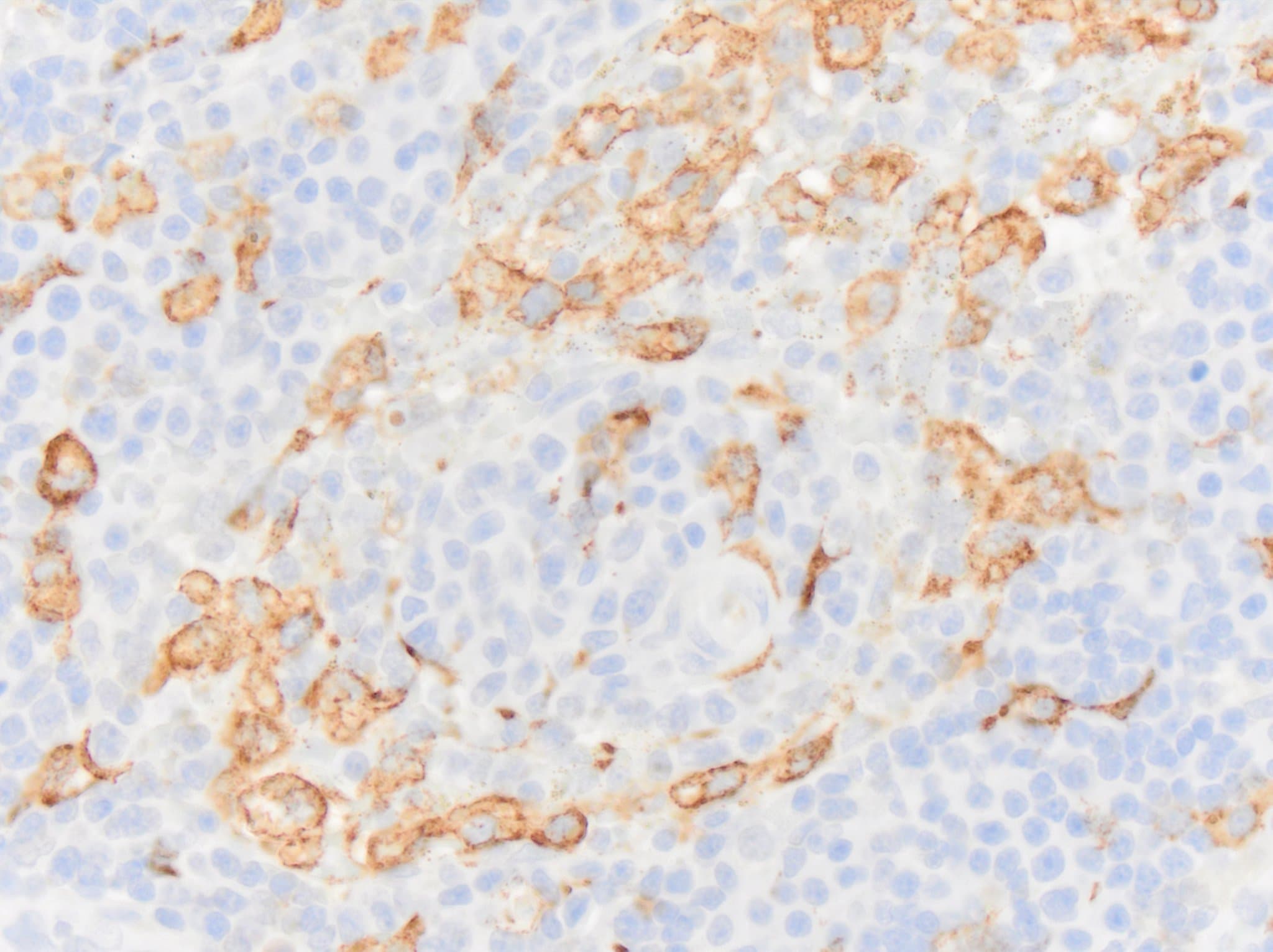 CD163 Antibody (EDHu-1) - BSA Free NB110-40686