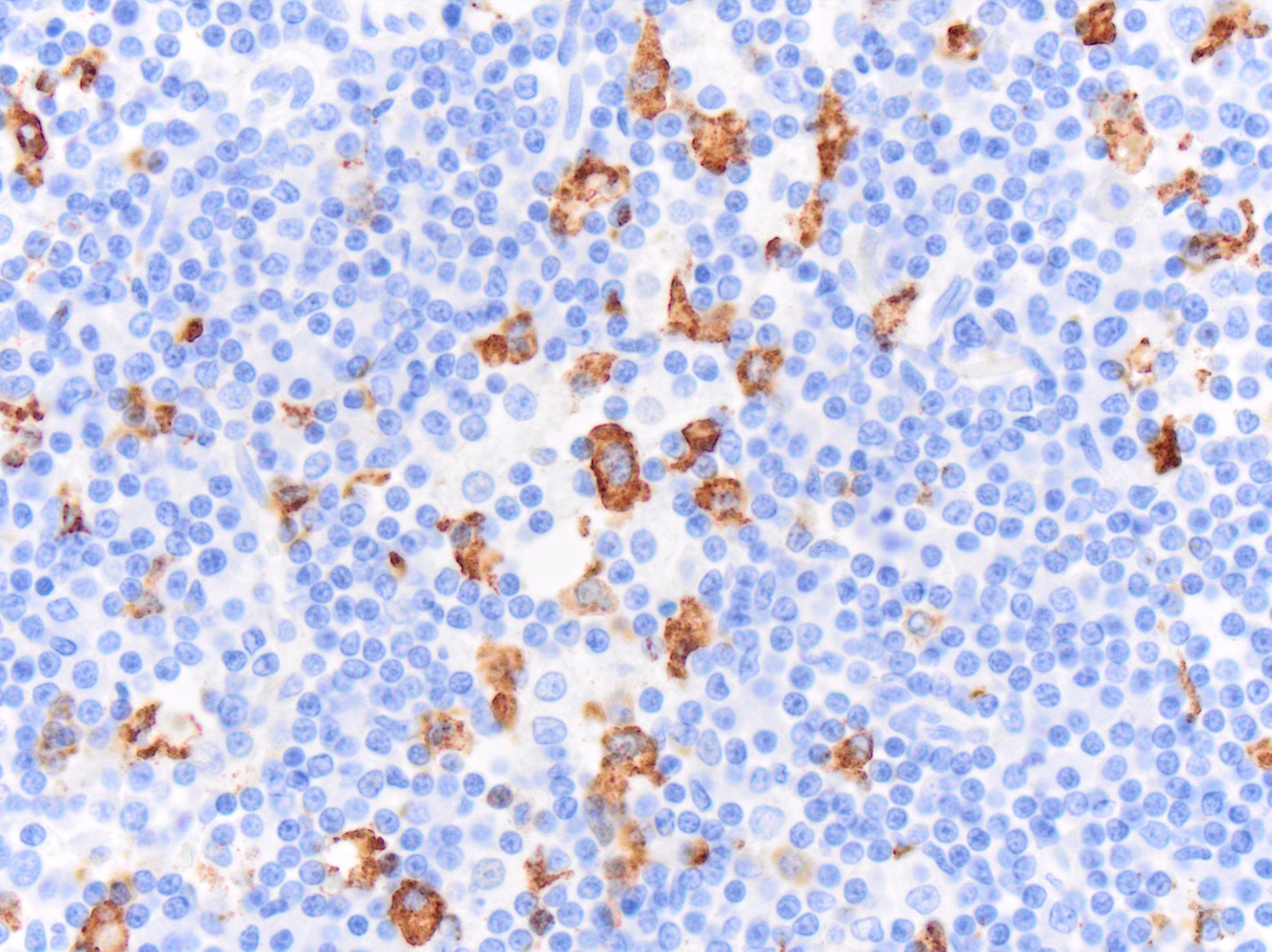 CD163 Antibody (EDHu-1) - BSA Free NB110-40686