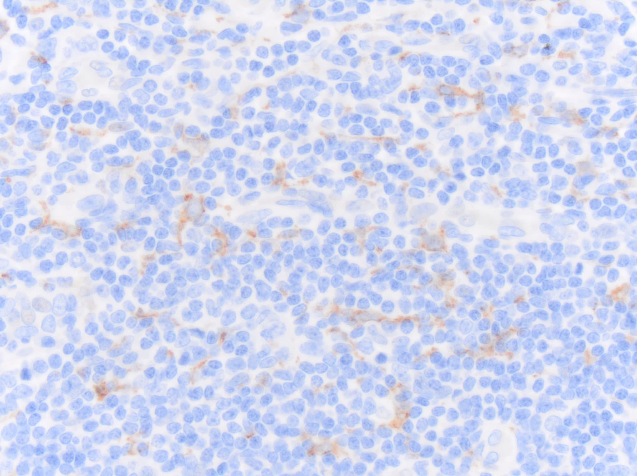 CD163 Antibody (EDHu-1) - BSA Free NB110-40686