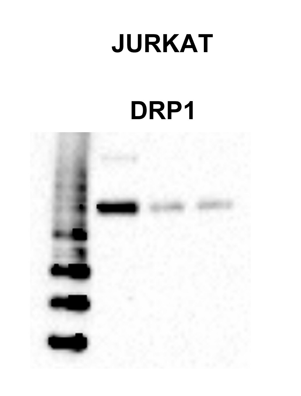 DRP1 Antibody - BSA Free NB110-55288