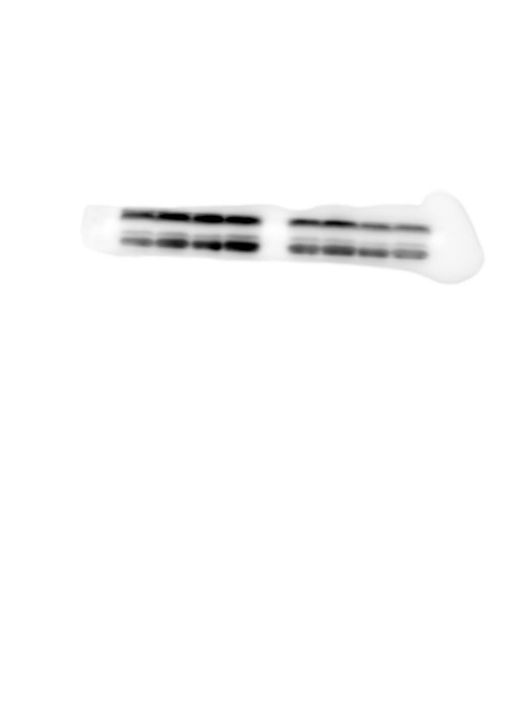 STIM1 Antibody (CDN3H4) - BSA Free NB110-55300