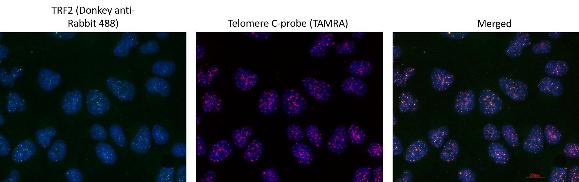 TRF-2 Antibody - BSA Free NB110-57130