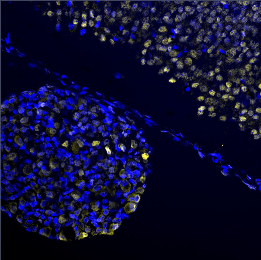 EGR2 Antibody - BSA Free NB110-59723