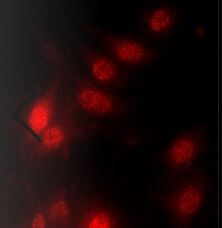 VEGF-C Antibody - Azide and BSA Free NB110-61022