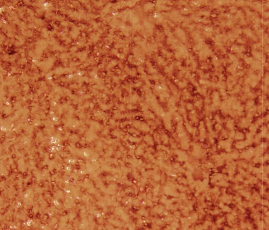 Hepatic Sinusoidal Endothelial Cells Antibody (SE-1) [FITC] NB110-68095F
