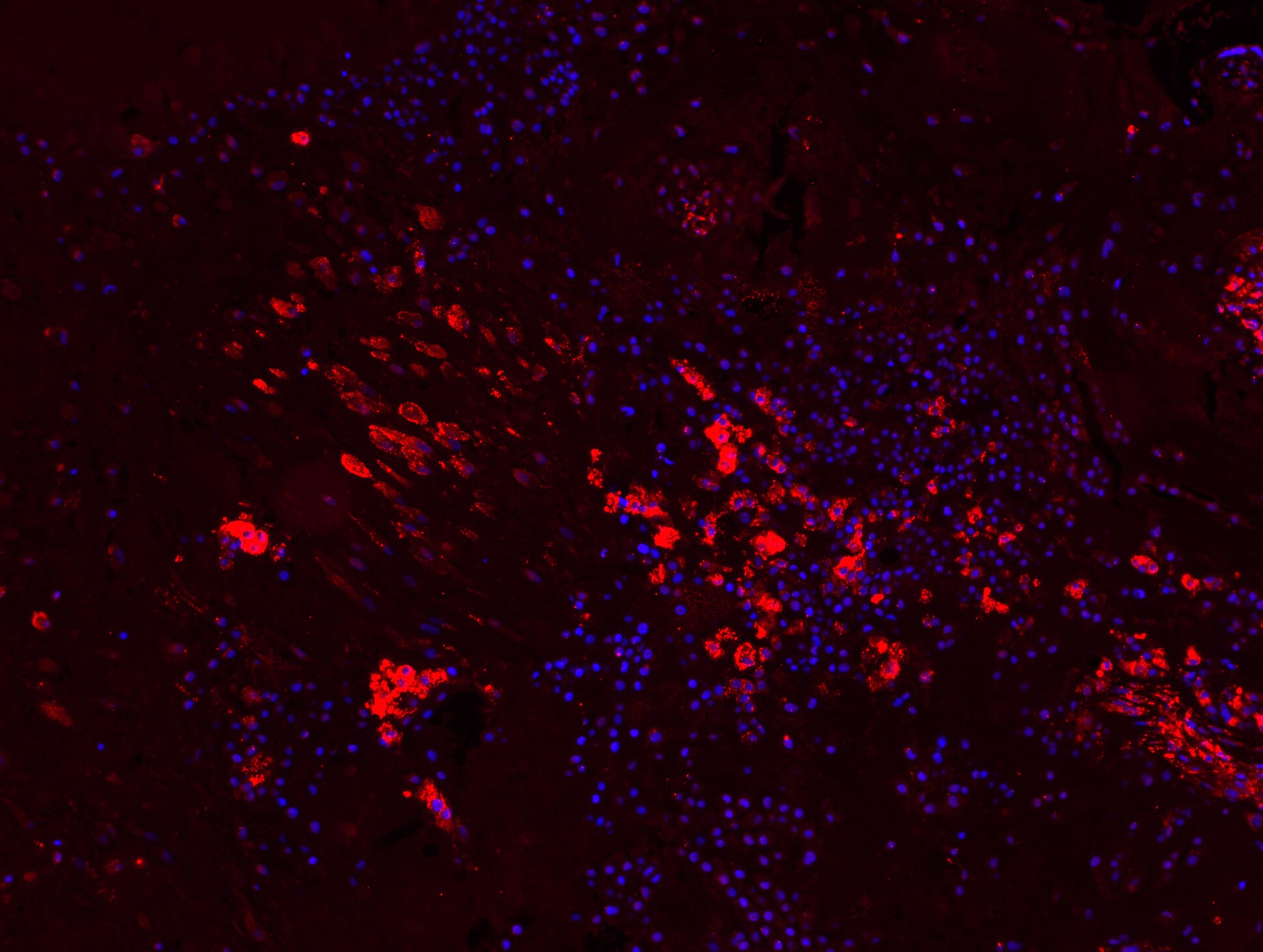 Tenascin C Antibody (4C8MS) - BSA Free NB110-68136
